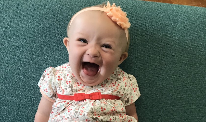 Bebê com Síndrome de Down