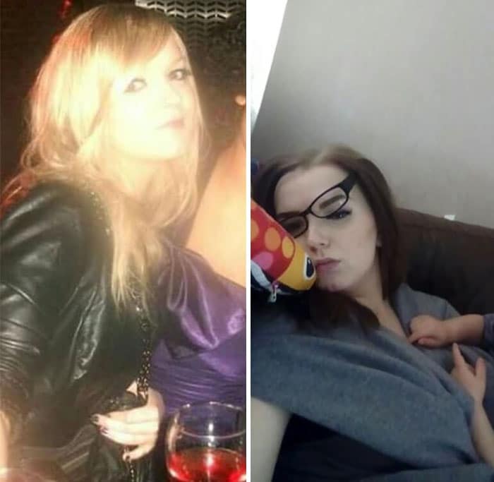 Fotos do "antes e depois"