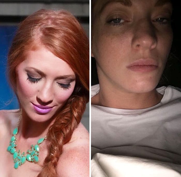 Fotos do "antes e depois"