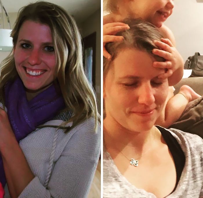 Fotos do "antes e depois"