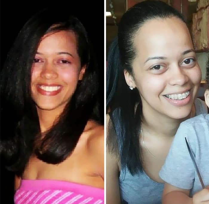 Fotos do "antes e depois"