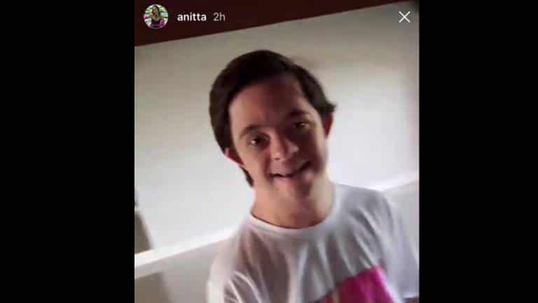 Dançarino-com-sindrome-de-down