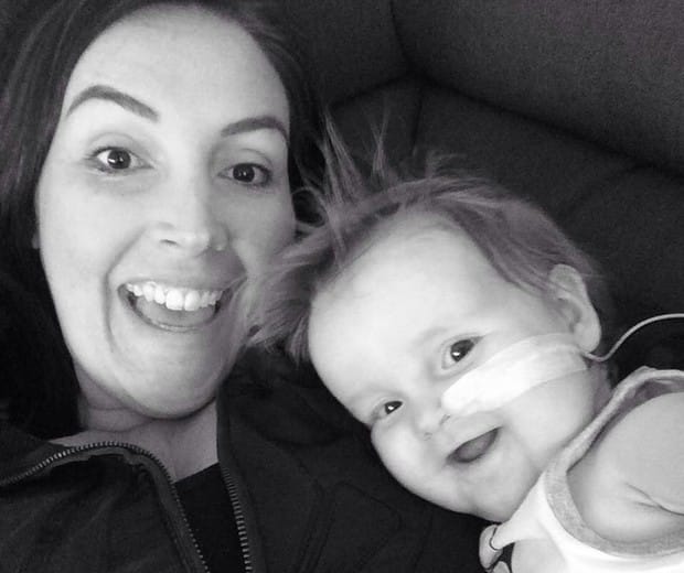 Bebê tem condição rara