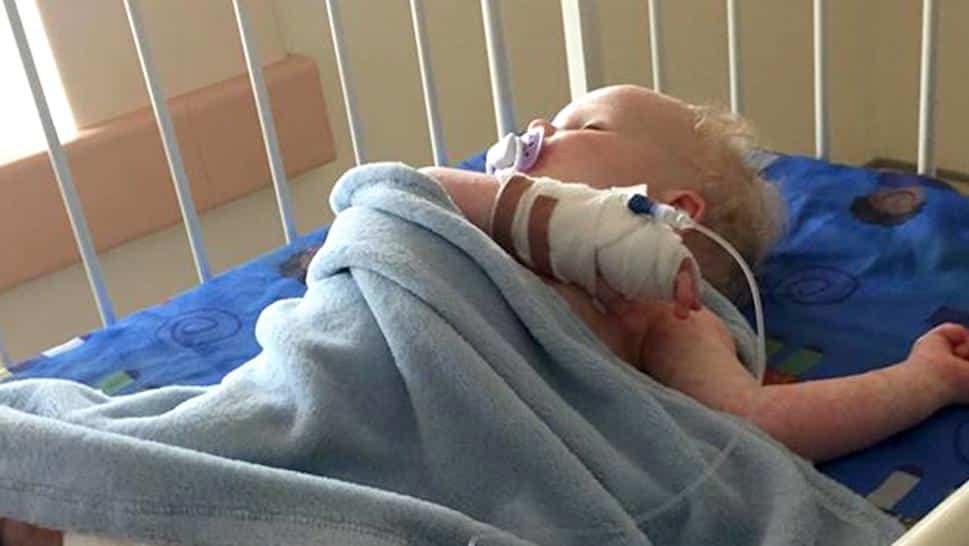 Menino contrai herpes por beijo