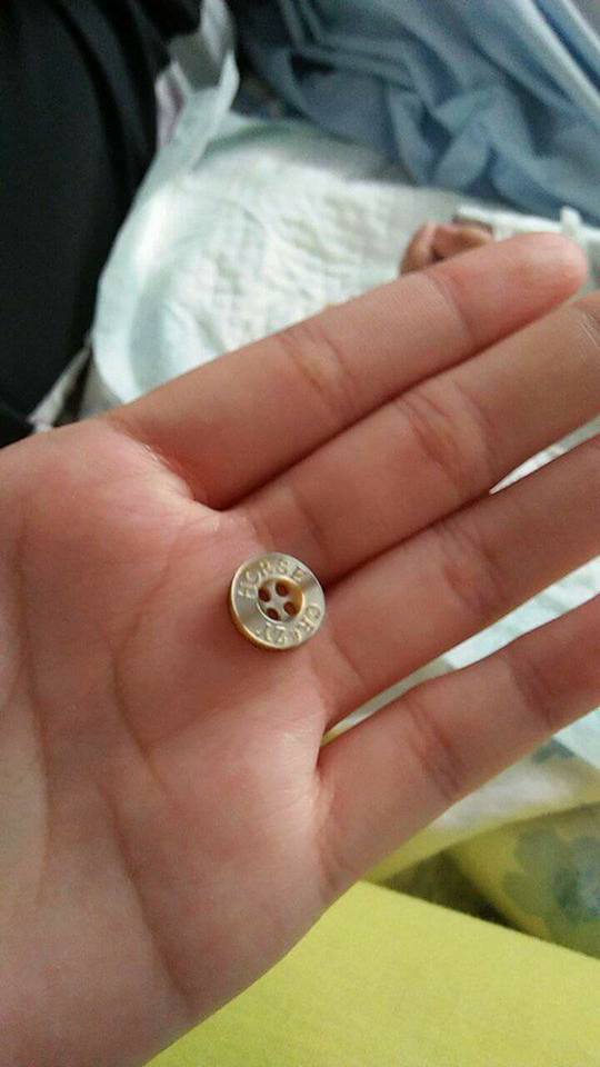 Menina fica com objeto dentro do nariz