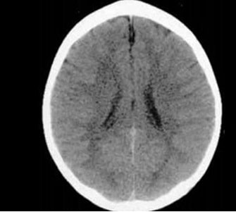Criança criada com amor e afeto