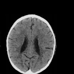 Criança criada sob maus-tratos