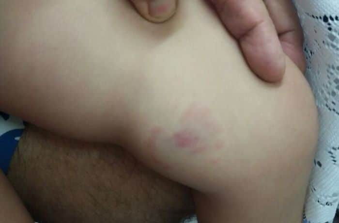 Mãe acusa creche de negligência  