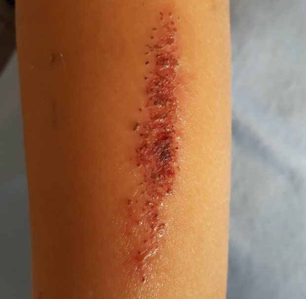 Desafio com borracha