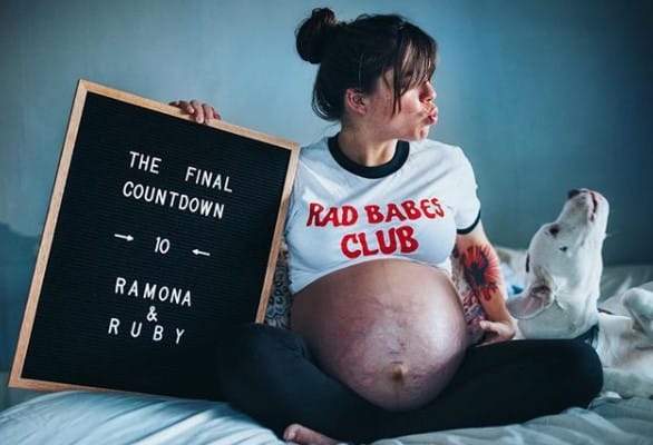 Mãe compartilha fotos de gravidez de gêmeas