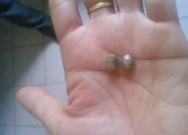 Menina morre após engolir baterias