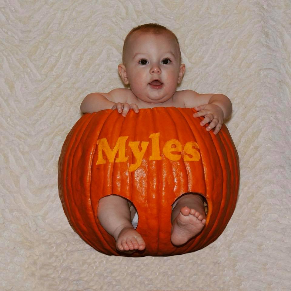 Mãe tem membros amputados