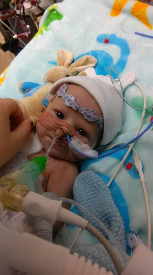 Bebê nasce com condição rara no coração