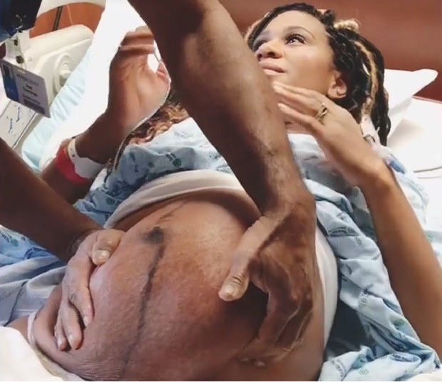 Médico gira bebê na barriga da mãe