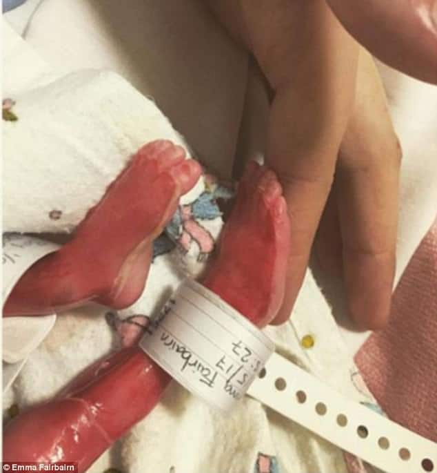 Mãe sofre acidente e bebê nasce sem vida