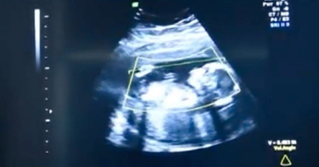 Mãe descobre detalhe assustador