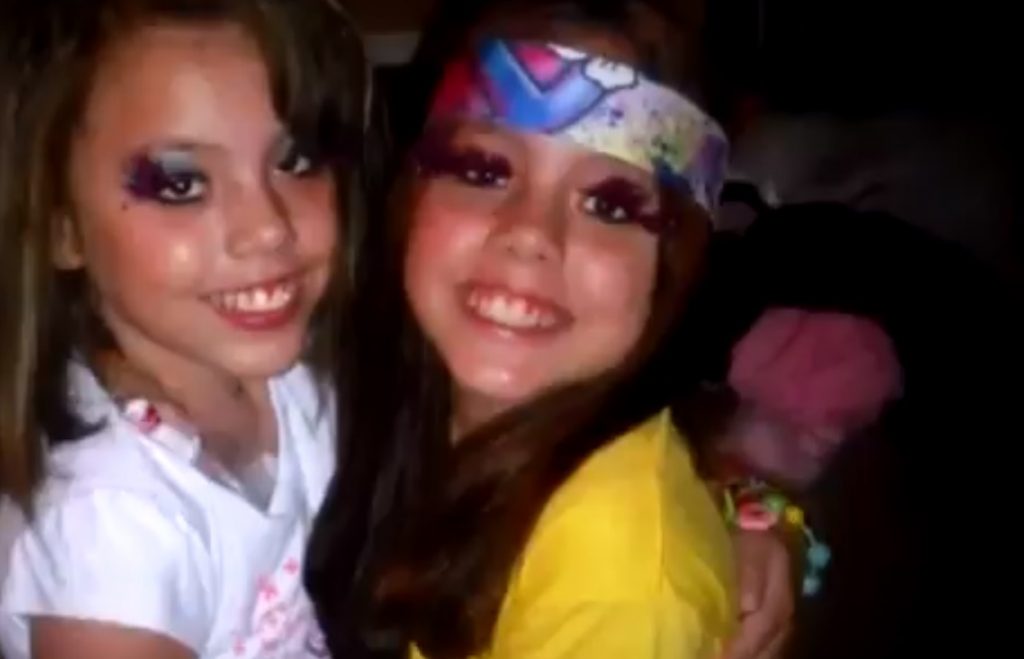 Gêmeas siamesas Gêmeas siamesas