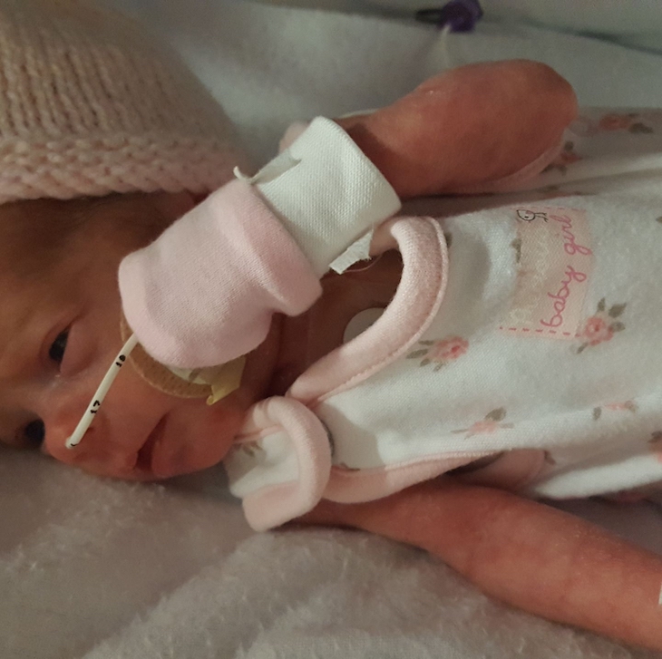 Médicos descobrem o pior com a ultrassom dessa bebê