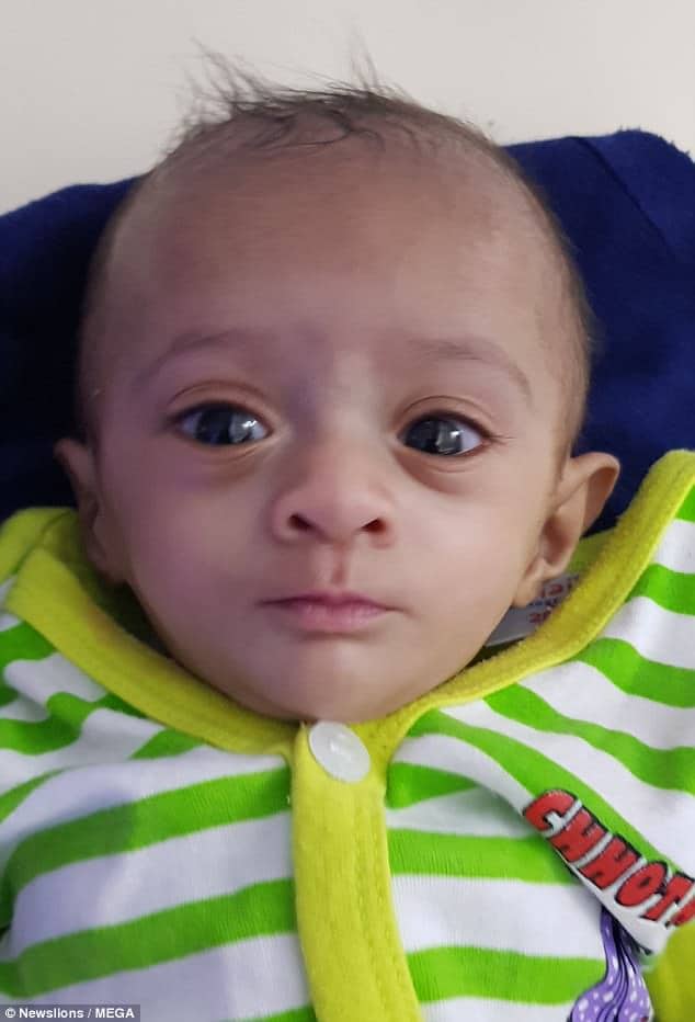 Bebê prematura mede menos que a palma de uma mão