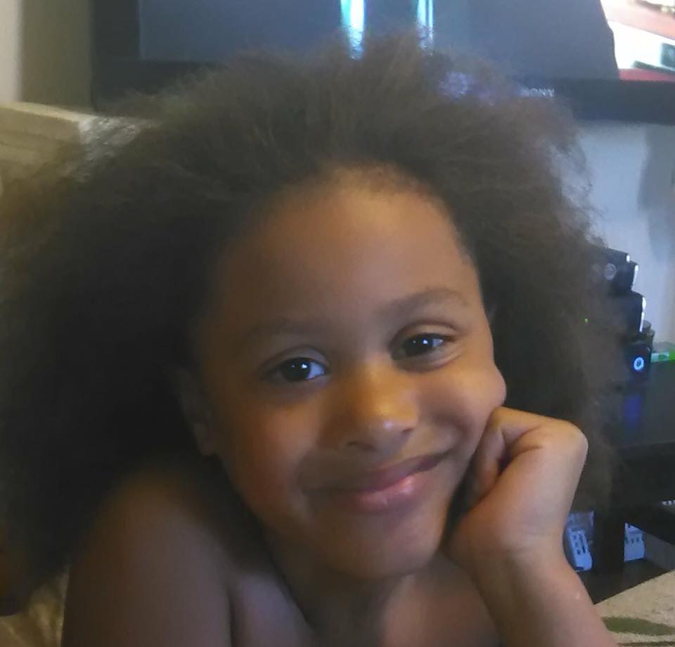 Menino com dor de cabeça sofre aneurisma