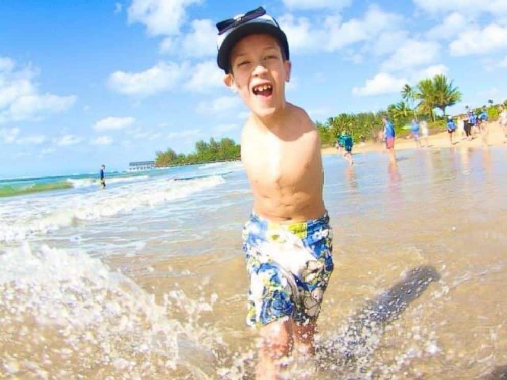 Mãe e filho nascem sem os braços