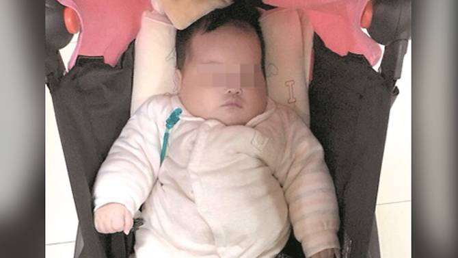 Bebê é abandonada pelos pais por ter epilepsia