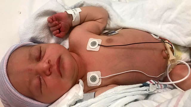 Bebê sofre com perfurações na cabeça durante parto