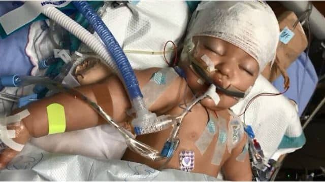 Bebê entra em coma após gripe evoluir para quadro mais sério