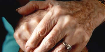 Médico ensina a eliminar manchas na pele