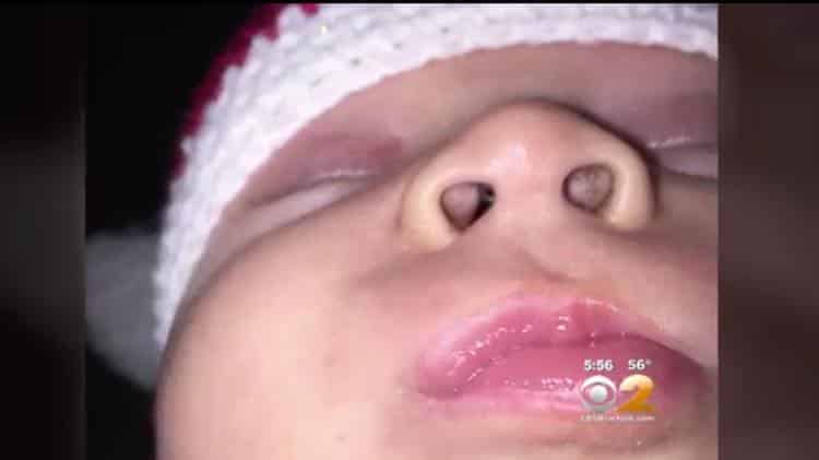 Mãe alerta sobre vela aromática Mãe alerta sobre vela aromática