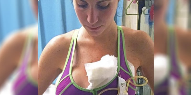 Mulher pega infecção do marido e por pouco não morre, deixando um alerta