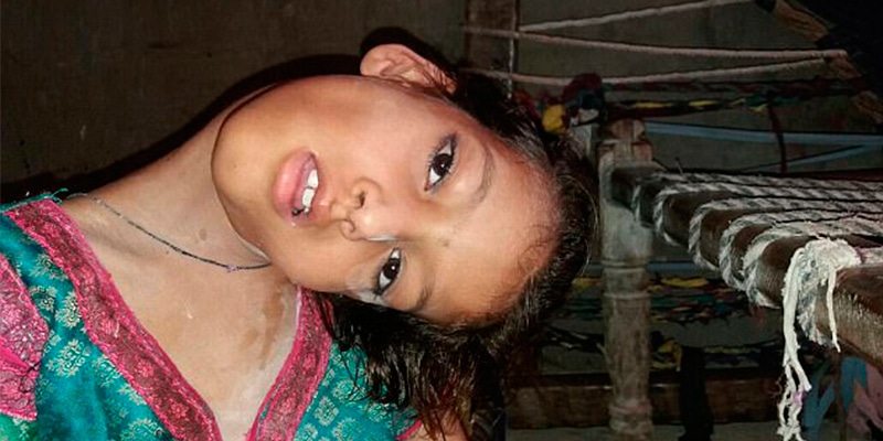 Ela ficou assim após uma lesão no pescoço. E nem os médicos sabem o que fazer