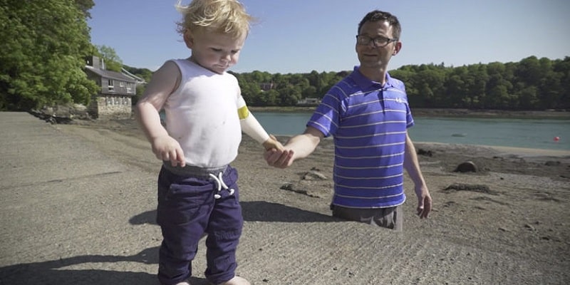 Pai vê o filho perder o braço ao nascer e desenvolve prótese para ajudá-lo