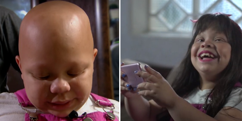 Campanha ajuda garotinha com alopecia