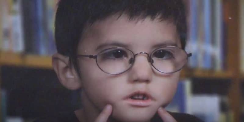 Médico deixa bebê portador de rara síndrome cair