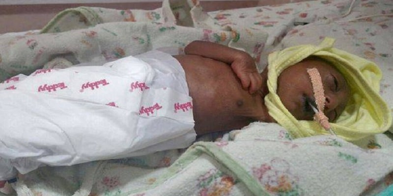 Bebê nasce com deformação na pele e, por vergonha, pais a abandonam. Somente seu avô a salvou