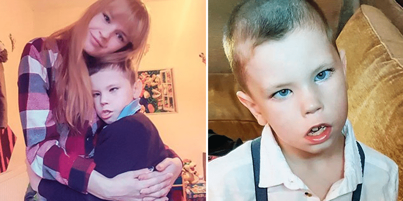 Menino de nove anos relata drama de síndrome que o impede de sorrir. É assim que todos veem seu rosto