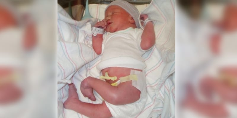Menina nasce com os joelhos invertidos. Mas após ser internada, médicos notam o que ela guarda para eles