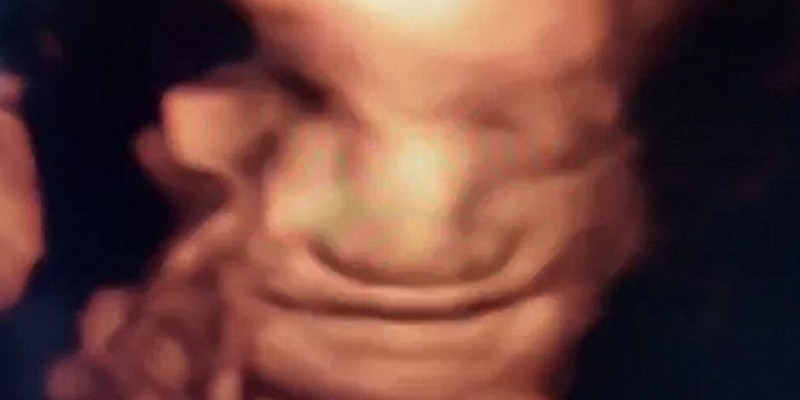 Bebê sorri em ultrassom