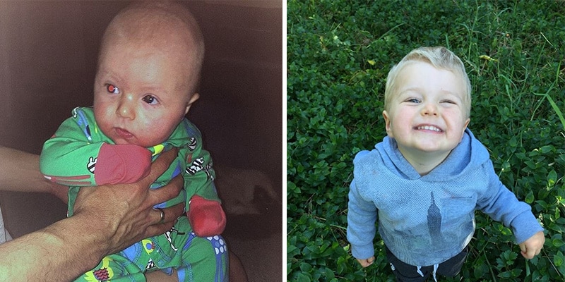 Mãe nota brilho dourado no olhar do filho. Mas o que parece ‘belo’ se torna um drama após visita ao hospital