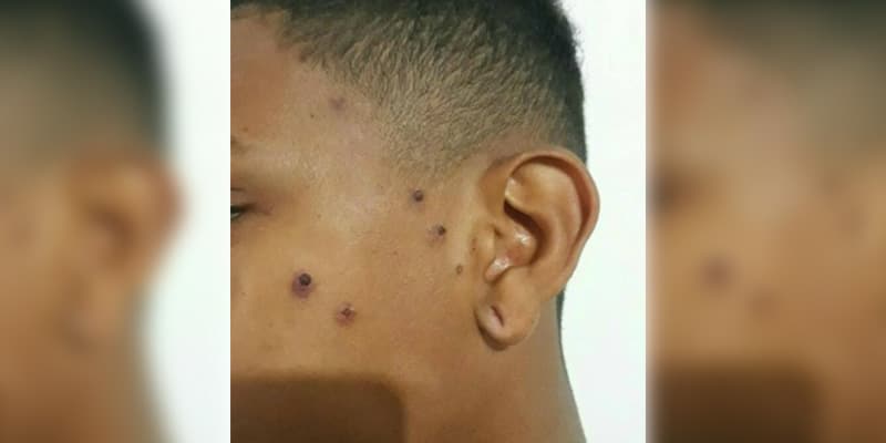 Mãe acusa seguranças de supermercado de espancar filho que saiu sem pagar um chocolate