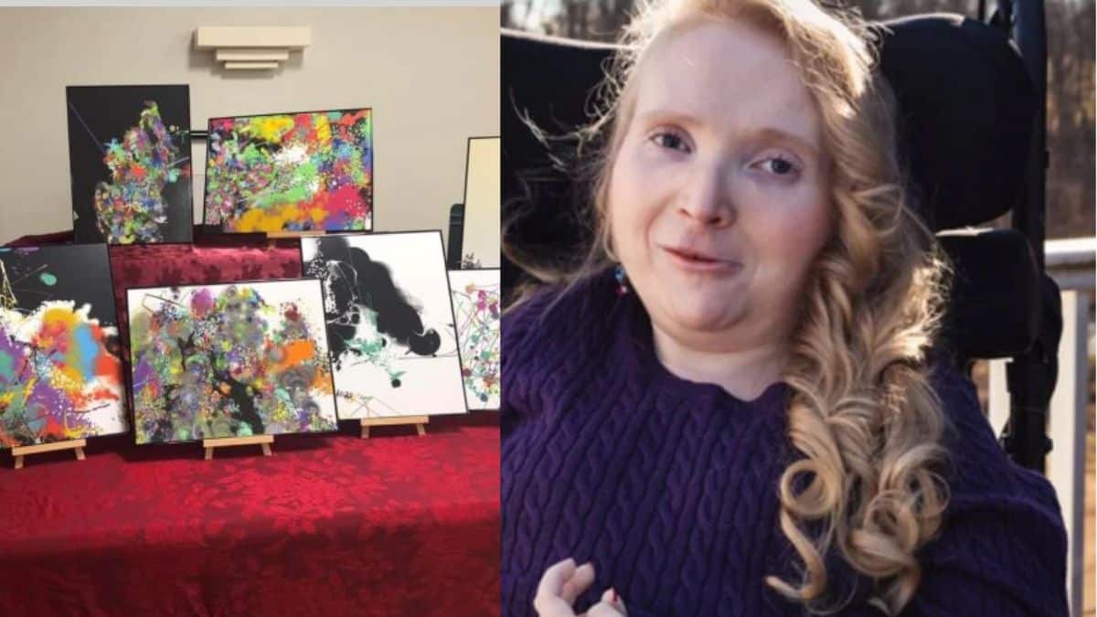 Mulher com síndrome de Rett pinta quadros com os olhos.