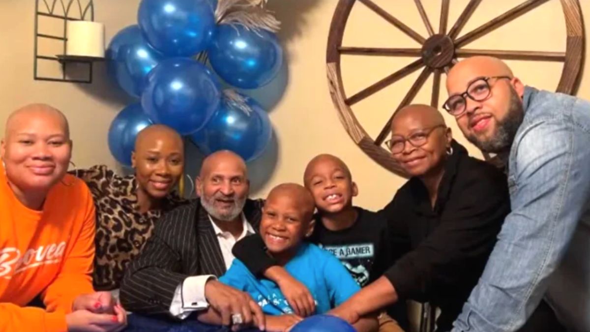 A doença que levou toda uma família a ficar careca. Nós te amamos!