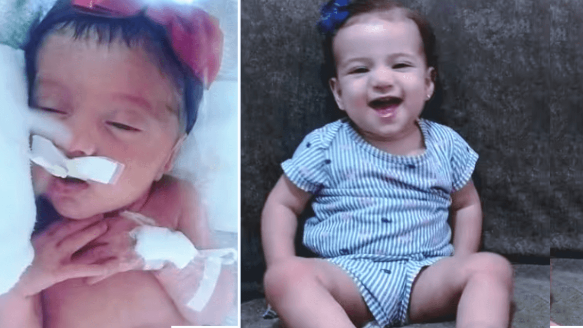 Bebê prematura supera expectativas médicas e vence complicações de meningite￼