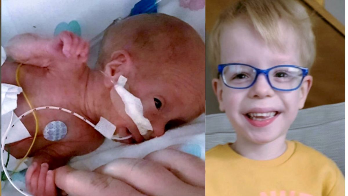 Prematuro com 10% de chances de viver, agora é um gênio aos 4 anos!