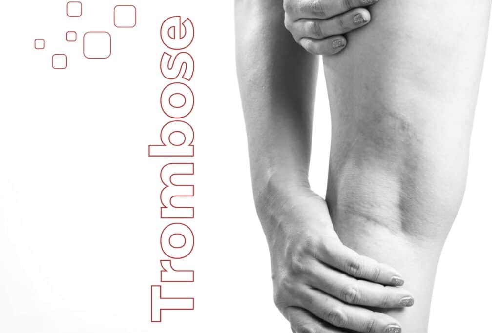 trombose