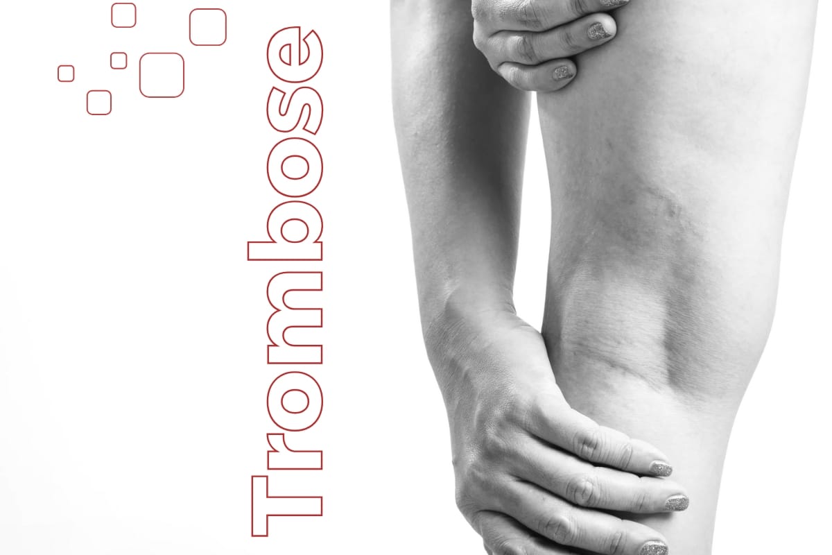 trombose
